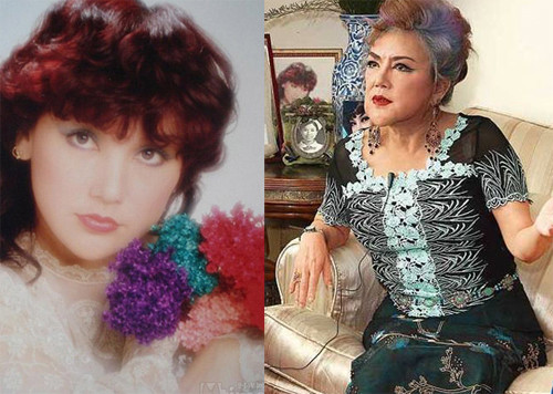 Thiệu Âm Âm là diễn viên gợi cảm nổi tiếng Hong Kong thập niên 1970. Để níu giữ nhan sắc lộng lẫy của mình, bà nhiều lần nhờ công nghệ thẩm mỹ can thiệp. Thiệu Âm Âm thừa nhận từng dùng silicon để độn cằm, bơm môi… Do bị ngã và chấn thương nặng, khuôn mặt “dao kéo” của bà bị ảnh hưởng lớn