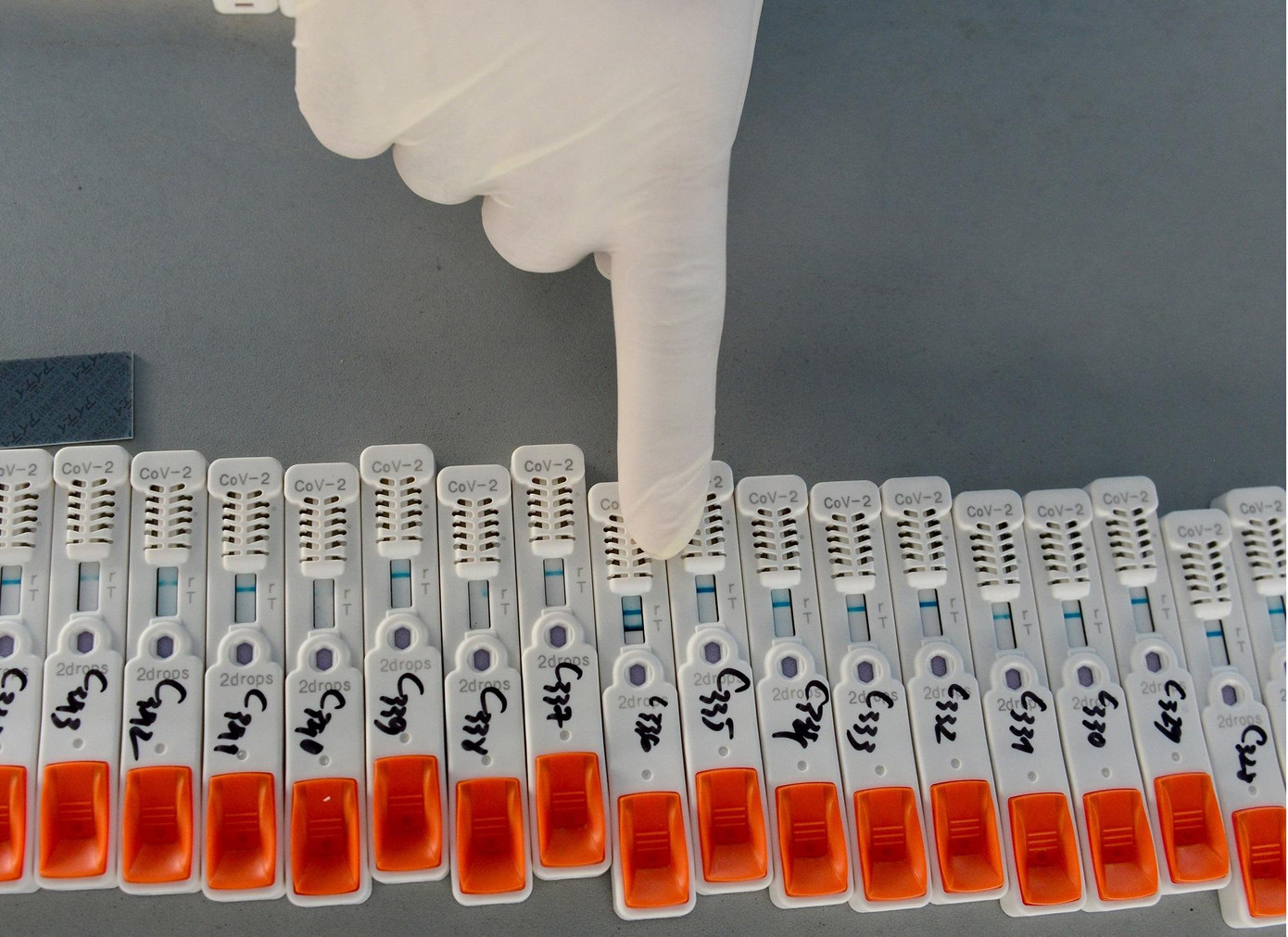 Mẫu 1 vạch là âm tính, mẫu cho kết quả 2 vạch là những trường hợp được xác định dương tính. Mẫu 1 vạch là âm tính, mẫu cho kết quả 2 vạch là những trường hợp được xác định dương tính.