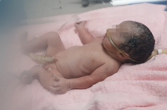 Bé trai đang được chăm sóc tại Bệnh viện Nhi Đồng Thành phố sức khỏe ổn định. Bé trai đang được chăm sóc tại Bệnh viện Nhi Đồng Thành phố sức khỏe ổn định.