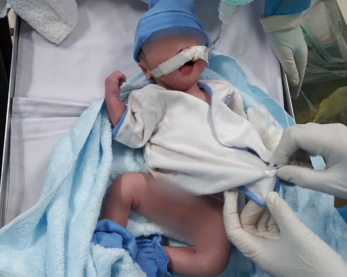 Các bác sĩ đã thực hiện cuộc mổ ngay trong khoa Hồi sức Cấp cứu giúp bé trai chào đời.