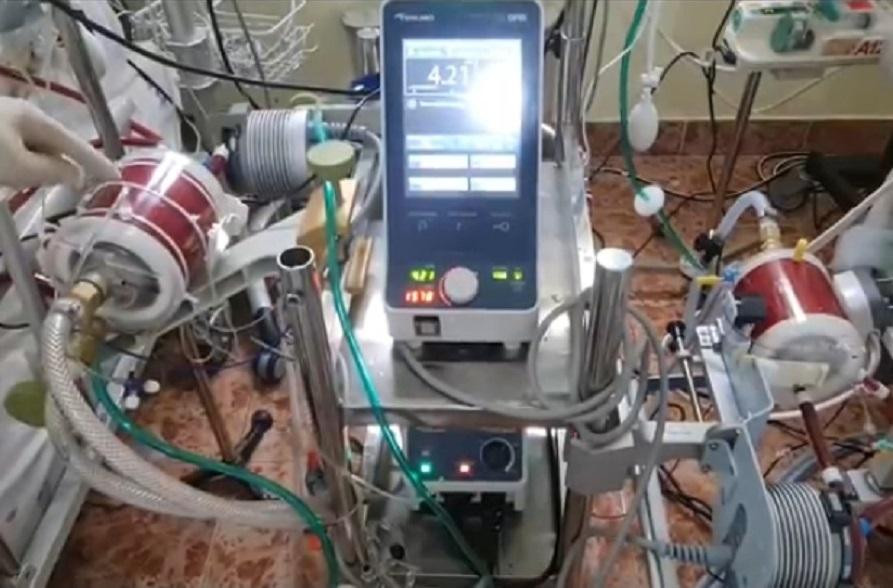 Thiết bị sau khi hoàn tất quy trình cải tiến đã kết nối với bệnh nhân và vận hành ổn định.