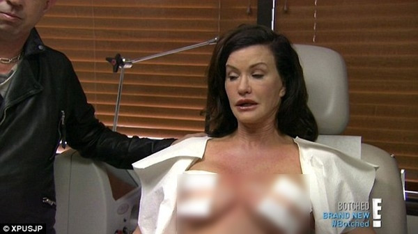 Cận cảnh ‘trùng tu’ bộ ngực giả của siêu mẫu Mỹ ảnh 1