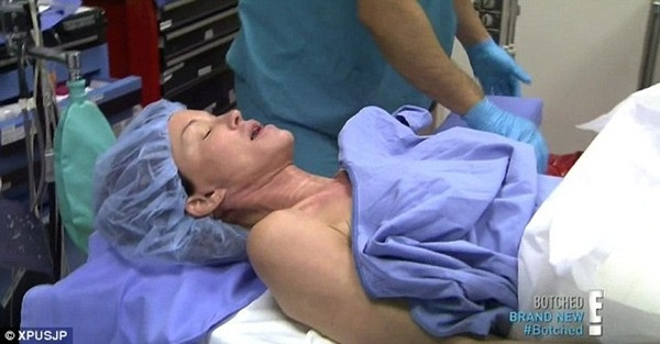 Cận cảnh ‘trùng tu’ bộ ngực giả của siêu mẫu Mỹ ảnh 6