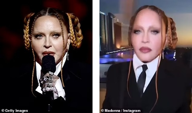 Ảnh thật và trên mạng xã hội của Madonna. Ảnh: Getty Images/IG. Ảnh thật và trên mạng xã hội của Madonna. Ảnh: Getty Images/IG.