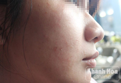 Tiền mất tật mang vì mỹ phẩm 'hàng hiệu' xách tay ảnh 1