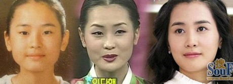 Gương mặt Lee Da Hae đã thay đổi nhiều