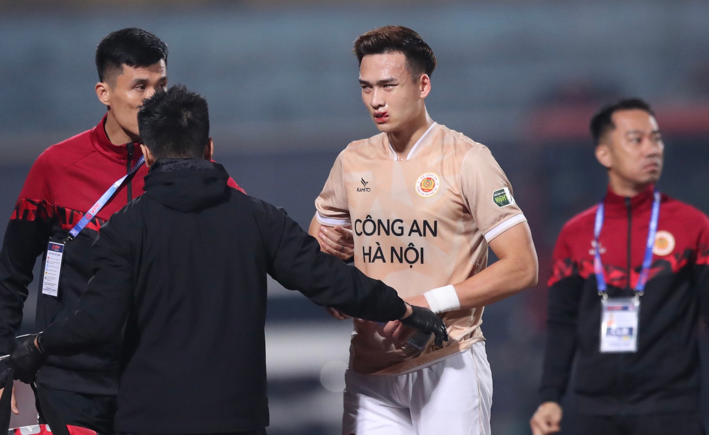 Cận cảnh chấn thương đáng sợ của Bùi Hoàng Việt Anh Cận cảnh chấn thương đáng sợ của Bùi Hoàng Việt Anh