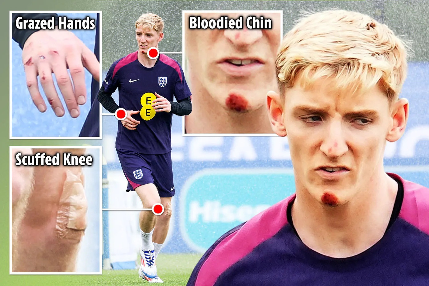 Gordon sây sát mặt mày Gordon sây sát mặt mày