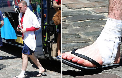 Rooney chấp nhận ngồi dự bị vì tôn trọng HLV Hodgson ảnh 1