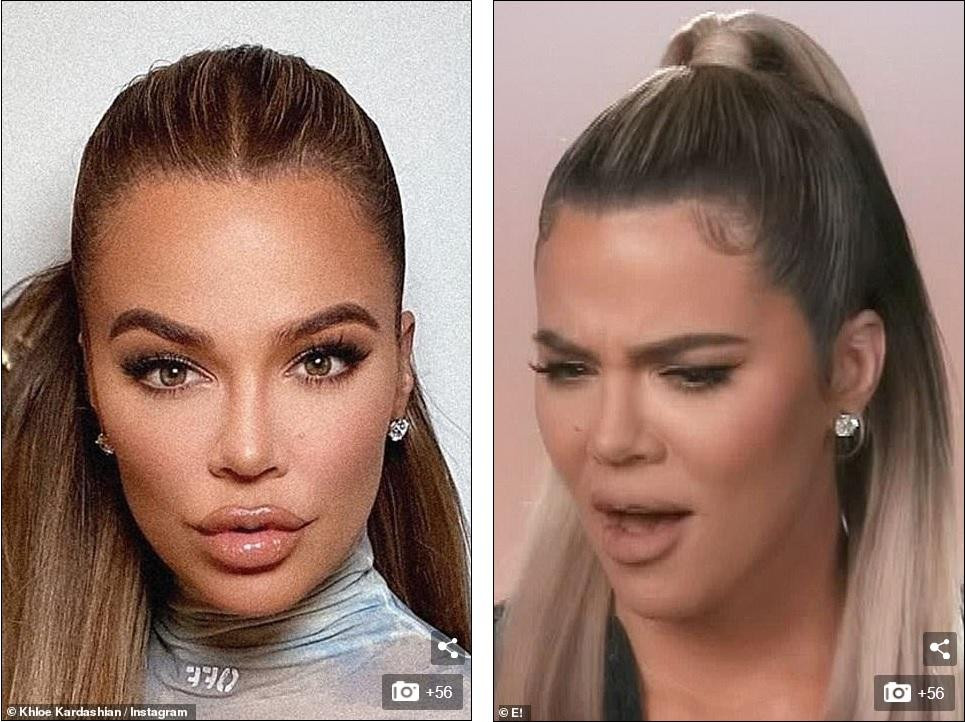 Cô cũng vướng nghi vấn đẹp lên nhờ phẫu thuật thẩm mỹ. Cô cũng vướng nghi vấn đẹp lên nhờ phẫu thuật thẩm mỹ.