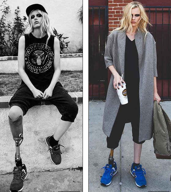 Người mẫu mất 1 chân vẫn trình diễn thời trang ảnh 5