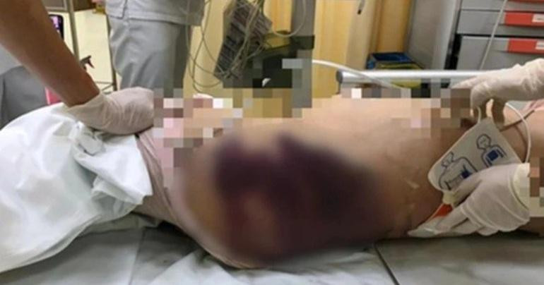 Bé gái 8 tuổi ở TPHCM bị người tình của bố đánh đập đến chết. Bé gái 8 tuổi ở TPHCM bị người tình của bố đánh đập đến chết.