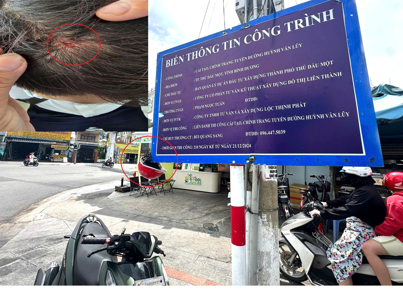 Một số người bị thương khi va trúng bảng thông tin này