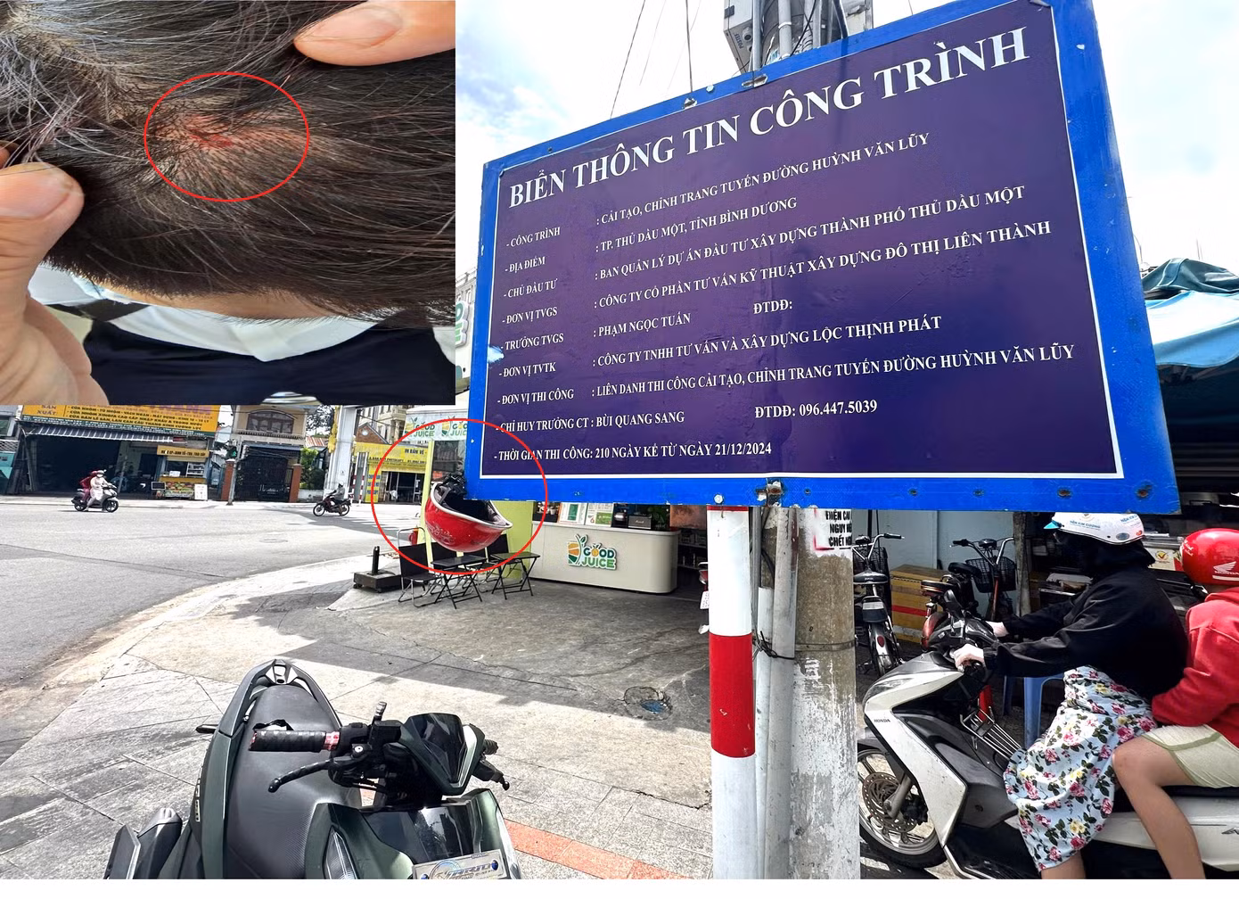 Một số người bị thương khi va trúng bảng thông tin này Một số người bị thương khi va trúng bảng thông tin này