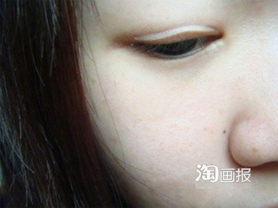 Dán lên mắt tại vị trí gần chân lông mi