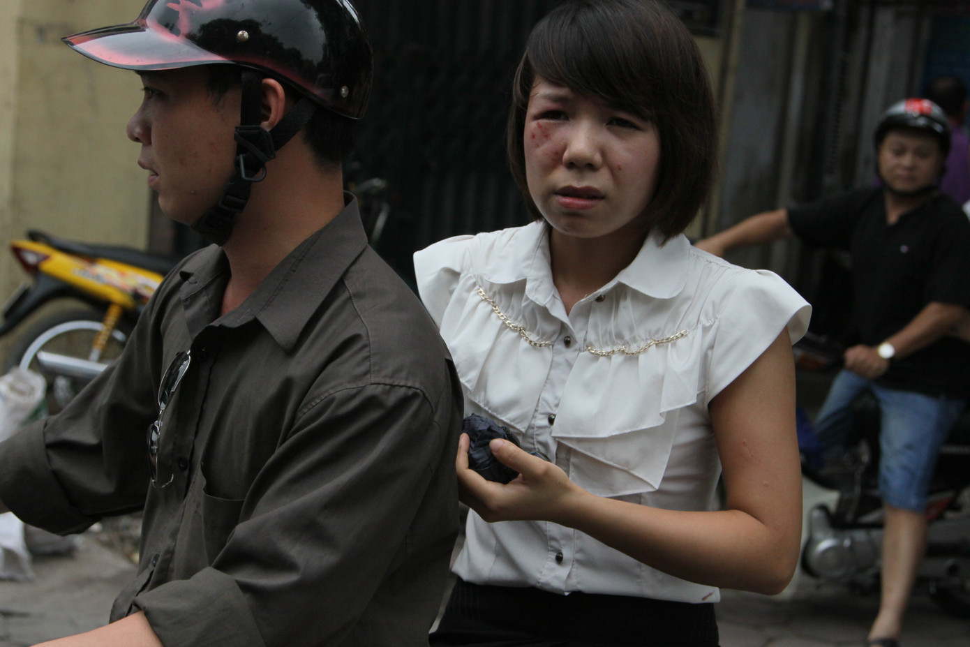 Nạn nhân được người dân đưa đi cấp cứu