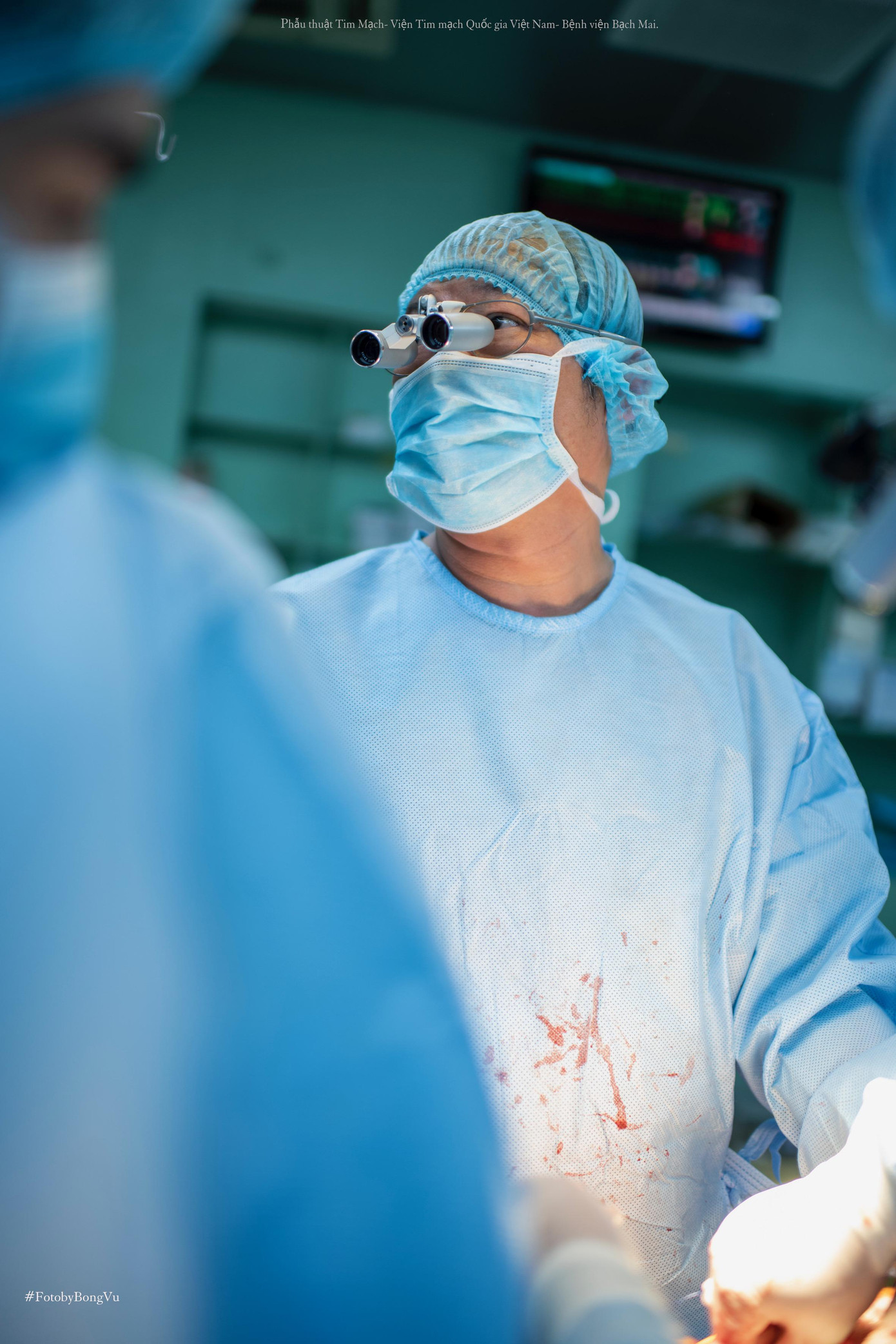 Trước một quyết định