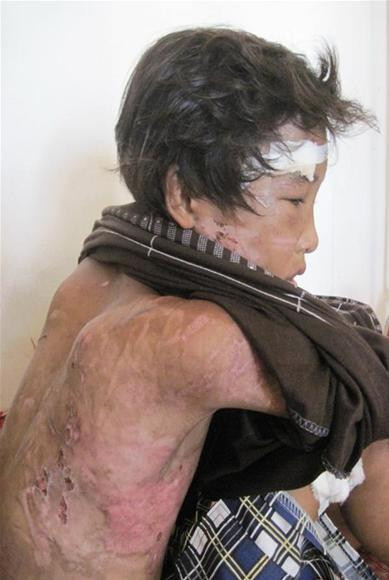 Kẻ thủ ác bị tuyên phạt 23 năm tù ảnh 10