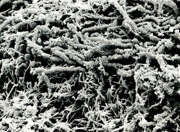 Mảng bám trên răng. Mảng bám trên răng