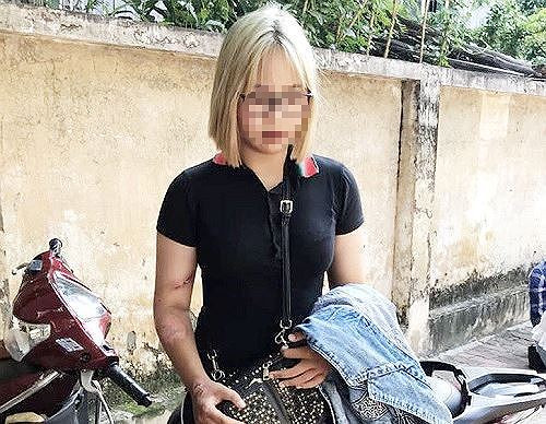 Vi phạm giao thông, thiếu nữ Hà Nội tăng ga tông gục 2 cảnh sát ảnh 1