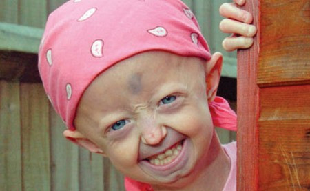 Hayley Okines mới 14 tuổi nhưng giống như người hơn 100 tuổi