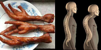 Một cách logic, thức ăn phù hợp đối với xương là xương.