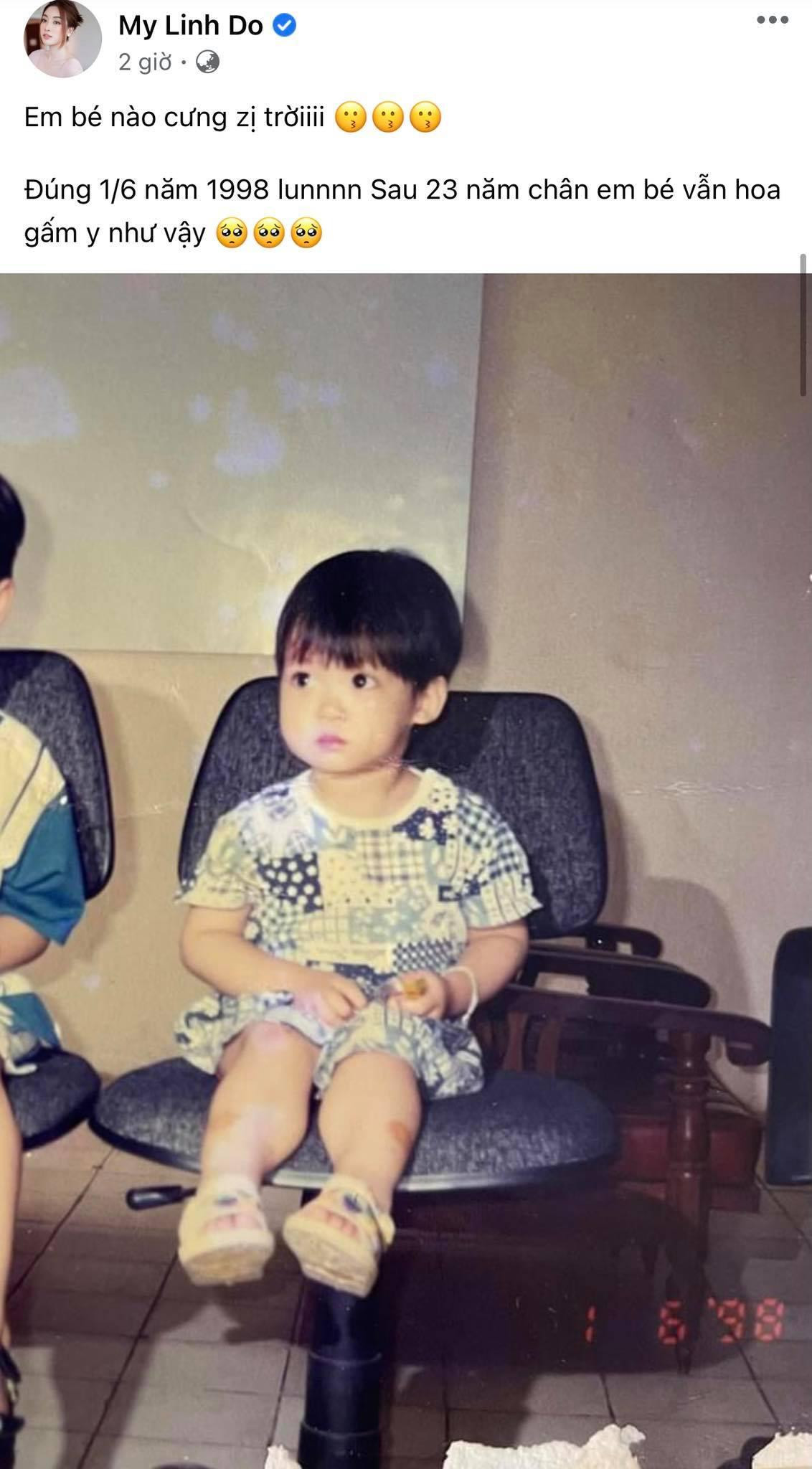 Hoa hậu Đỗ Mỹ Linh khoe ảnh năm 2 tuổi, lúc này cô khá nghịch ngợm nên thường xuyên có vết trầy trên chân. Hoa hậu Đỗ Mỹ Linh khoe ảnh năm 2 tuổi, lúc này cô khá nghịch ngợm nên thường xuyên có vết trầy trên chân.