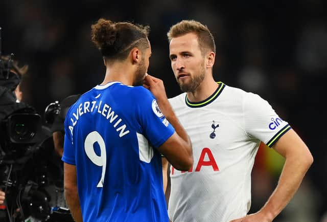 Everton vẫn chưa có sự phục vụ của Calvert-Lewin