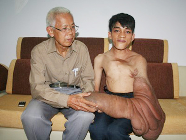 Thanh Vũ khao khát có cơ hội được giải thoát khỏi những khối bướu