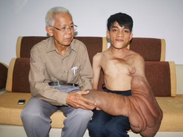 Thanh Vũ khao khát có cơ hội được giải thoát khỏi những khối bướu. Thanh Vũ khao khát có cơ hội được giải thoát khỏi những khối bướu