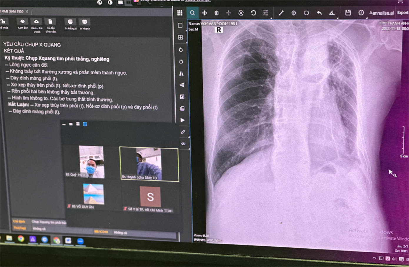 Thiết bị hiện đại giúp các bác sĩ từ đảo chuyển hình ảnh, thông tin hội chẩn với chuyên gia ở đất liền