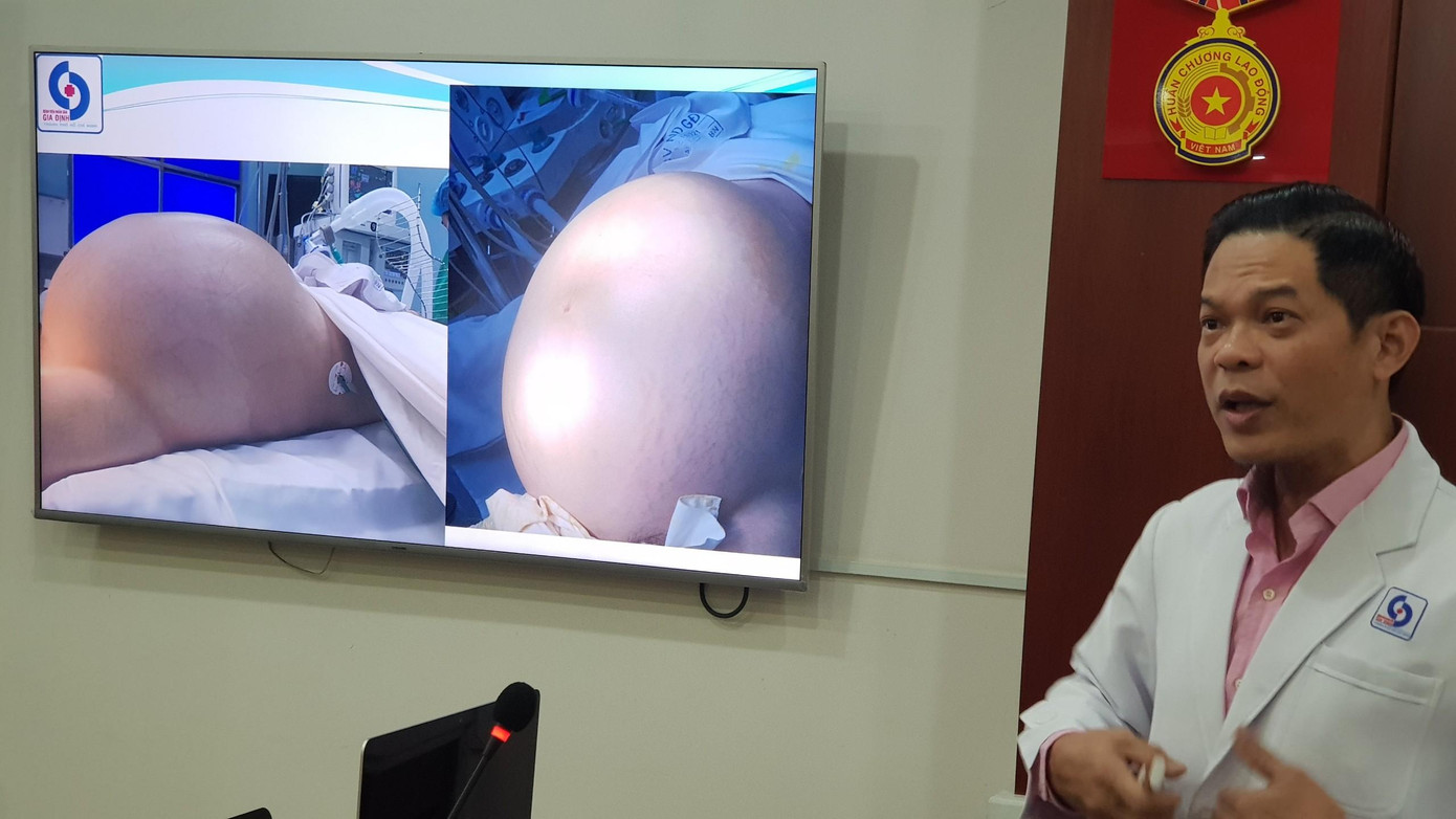 BS Bùi Chí Thương chia sẻ thông tin về việc tiếp nhận, phẫu thuật cho người bệnh