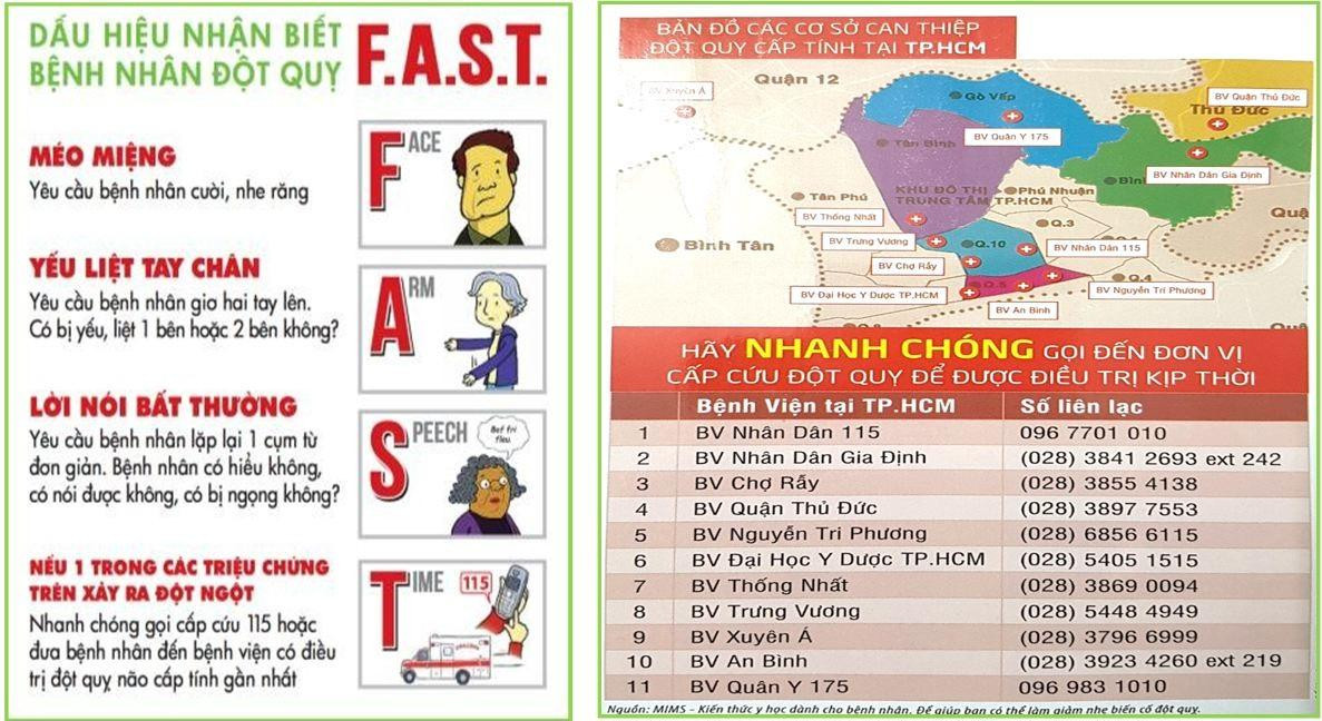 Dấu hiệu nhận biết đột quỵ và các cơ sở y tế cấp cứu, can thiệp đột quỵ tại TPHCM Dấu hiệu nhận biết đột quỵ và các cơ sở y tế cấp cứu, can thiệp đột quỵ tại TPHCM