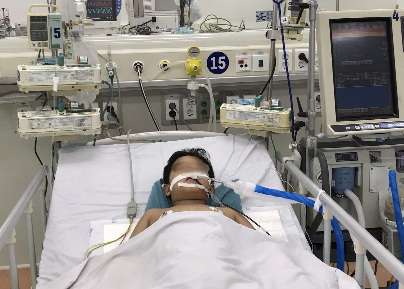 Bệnh nhi đang được theo dõi, điều trị liên tục tại Bệnh viện Nhi Đồng 1 (ảnh: BSCC) Bệnh nhi đang được theo dõi, điều trị liên tục tại Bệnh viện Nhi Đồng 1 (ảnh: BSCC)