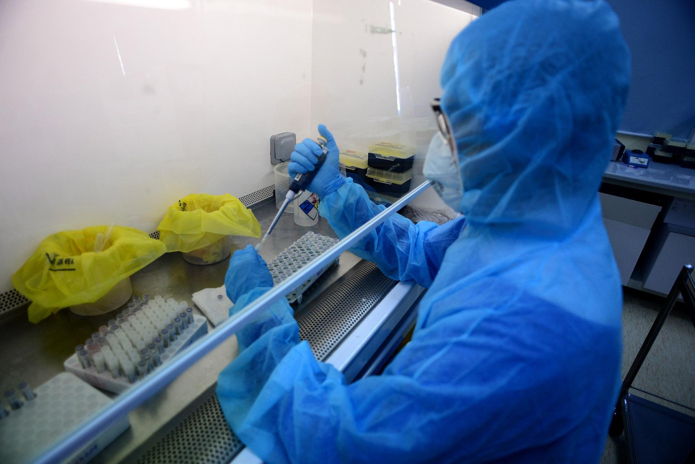 Hệ thống giám sát chủ động của ngành y tế TPHCM đã phát hiện trường hợp bệnh đậu mùa khỉ đầu tiên Hệ thống giám sát chủ động của ngành y tế TPHCM đã phát hiện trường hợp bệnh đậu mùa khỉ đầu tiên