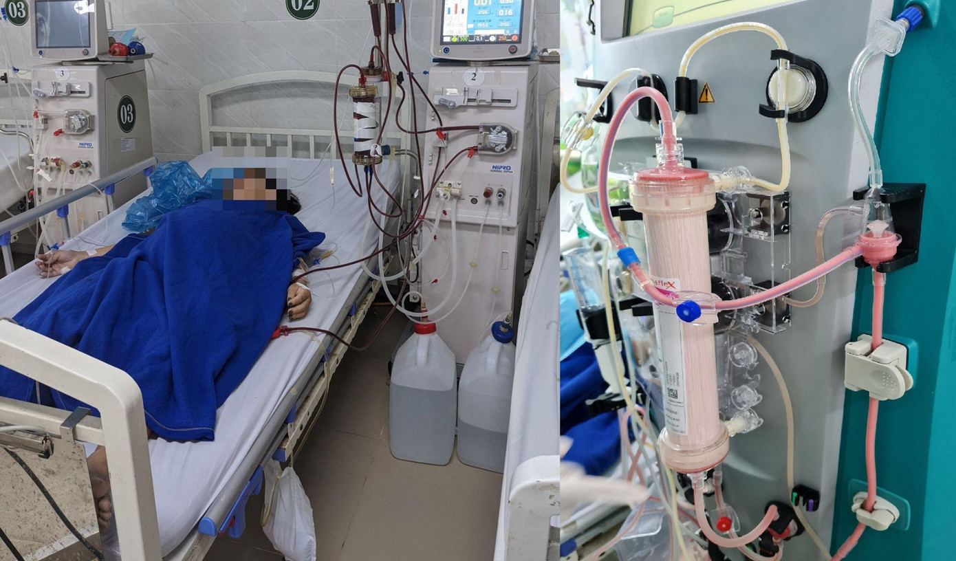 Một trường hợp bị viêm tụy cấp điều trị tại Bệnh viện Lê Văn Thịnh (ảnh: BVCC)