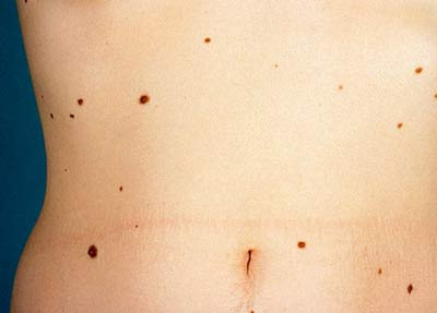 . Ảnh: minh họa - Internet . Ảnh: minh họa - Internet