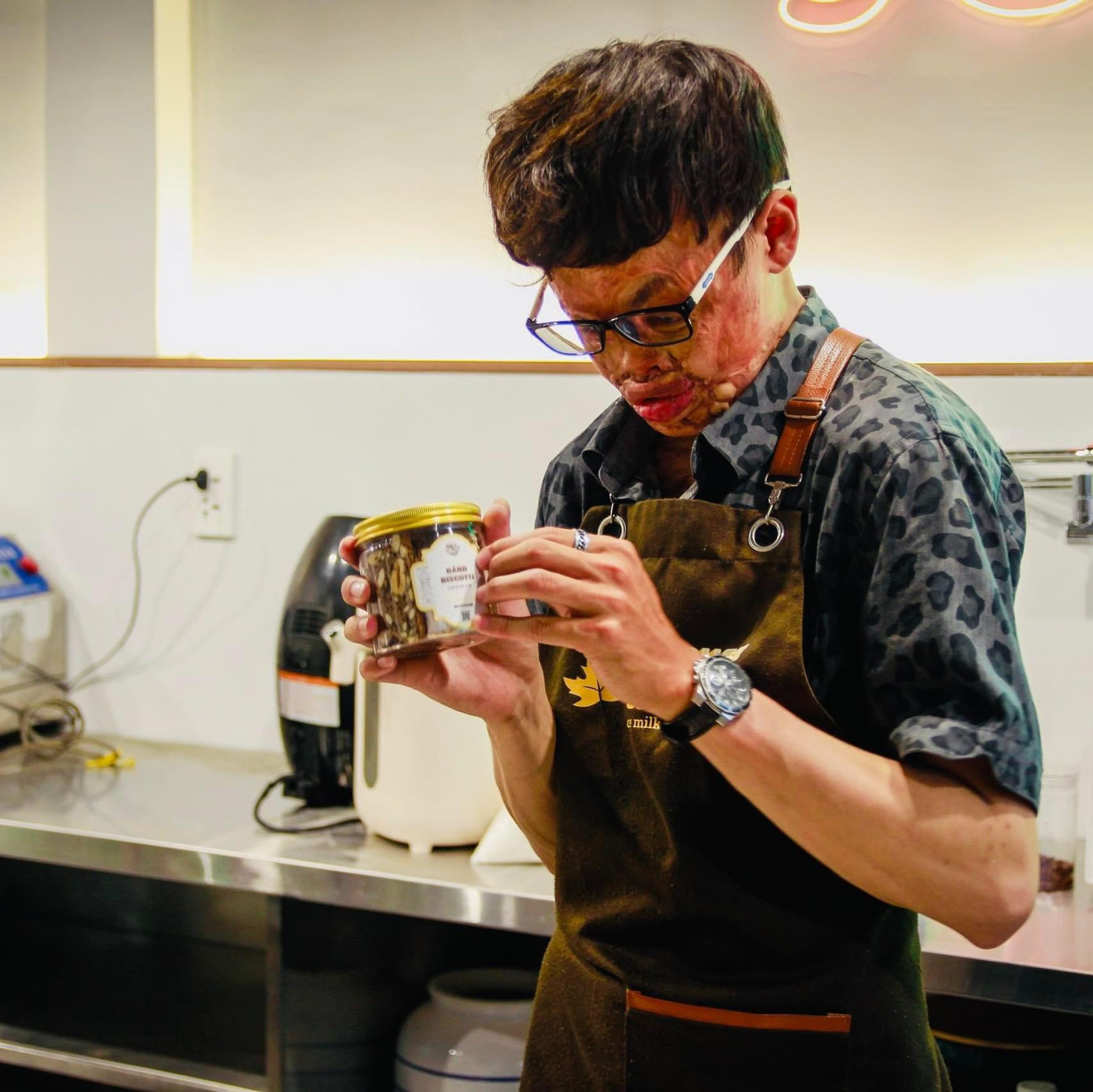 Những vết sẹo từ tuổi thơ hằn sâu trên gương mặt của chàng trai Ngô Quý Hải đến hiện tại. (Ảnh:NVCC)