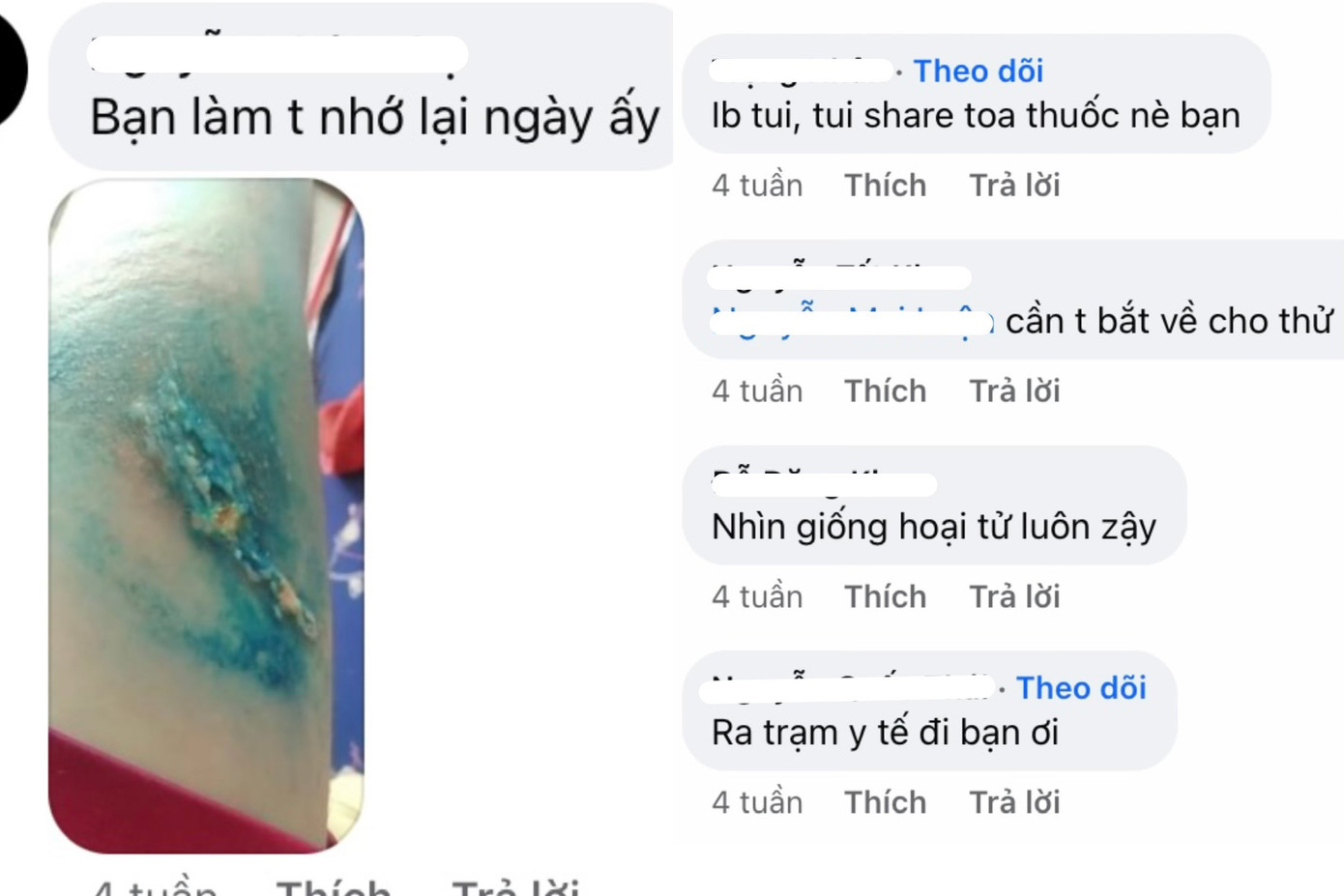 Những nạn nhân sinh viên bị kiến ba khoang đốt chia sẻ lại hình ảnh.