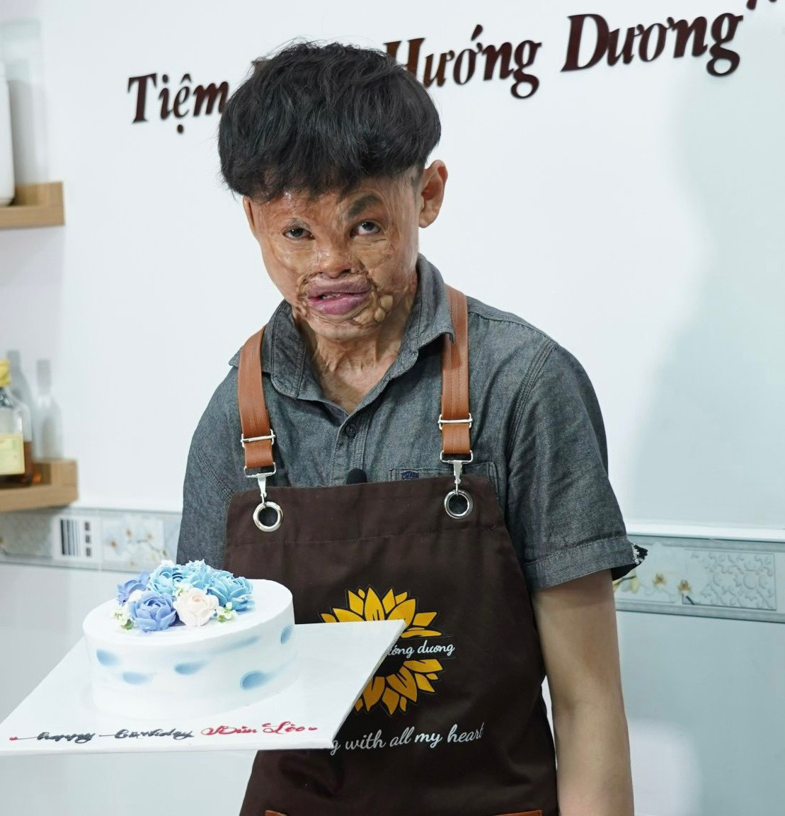 Hải cặm cụi làm bánh tại tiệm Hướng Dương. Đây là tiệm bánh có tên gọi của loài hoa luôn hướng về phía ánh sáng và vươn lên trong cuộc sống. (Ảnh: NVCC)