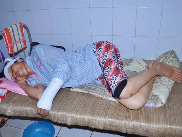 Bà Nguyễn Thị Thu bị đánh gãy tay, đang phải nằm viện điều trị