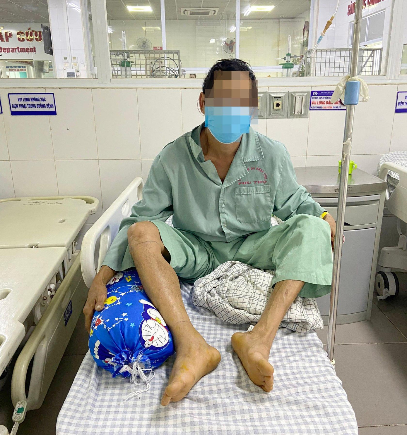 Bệnh nhân bị rắn lục tre cắn và được các BS cứu sống kịp thời. Ảnh: BV cung cấp