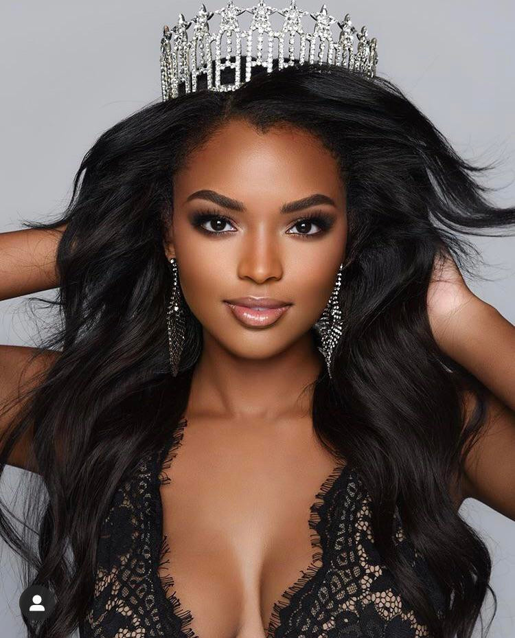 Hoa hậu Mỹ 2003 Susie Castillo ủng hộ việc bỏ giới hạn tuổi dự thi, trong khi đó Asya Branch - Hoa hậu Mỹ 2020 lại tỏ ra hoài nghi.