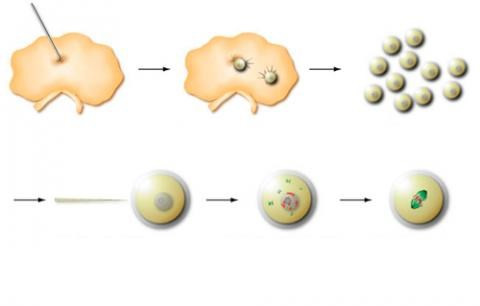  Trưởng thành trứng trong ống nghiệm (IVM). Với phương pháp IVM (Invitro Maturation of Oocytes), trứng chưa trưởng thành được lấy ra từ buồng trứng chưa được kích thích, bệnh nhân không cần chích thuốc kích thích buồng trứng nhiều như trong thụ tinh ống nghiệm bình thường. Thực hiện phương pháp này sẽ giảm được nhiều chi phí và tránh được hội chứng quá kích buồng trứng. Trong thời gian đó, tinh trùng cũng được lấy từ cơ thể người chồng. Trứng và tinh trùng được cho thụ tinh