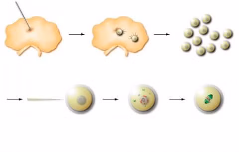  Trưởng thành trứng trong ống nghiệm (IVM). Với phương pháp IVM (Invitro Maturation of Oocytes), trứng chưa trưởng thành được lấy ra từ buồng trứng chưa được kích thích, bệnh nhân không cần chích thuốc kích thích buồng trứng nhiều như trong thụ tinh ống nghiệm bình thường. Thực hiện phương pháp này sẽ giảm được nhiều chi phí và tránh được hội chứng quá kích buồng trứng. Trong thời gian đó, tinh trùng cũng được lấy từ cơ thể người chồng. Trứng và tinh trùng được cho thụ tinh