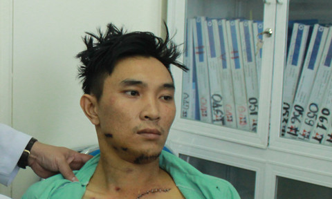 Lời kể hãi hùng của người bị giang hồ nã súng giữa phố ảnh 1