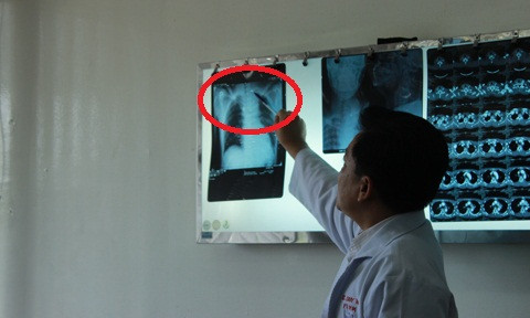 Lời kể hãi hùng của người bị giang hồ nã súng giữa phố ảnh 4