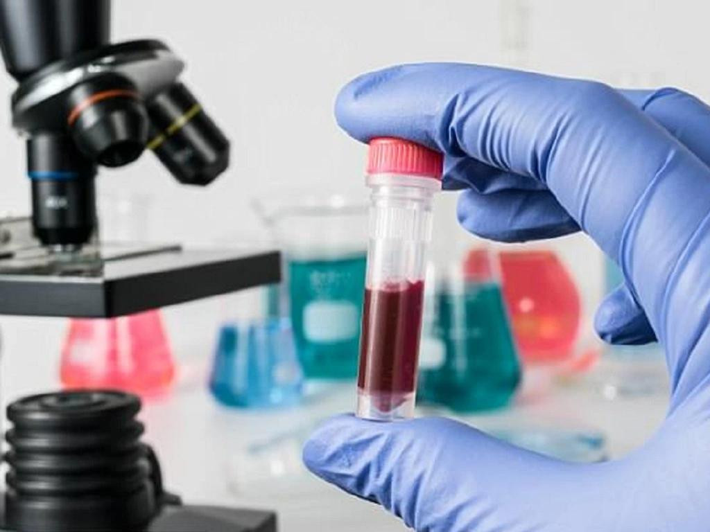 Những bệnh về máu thường diễn biến thầm lặng, các dấu hiệu ban đầu dễ bị nhầm lẫn với những vấn đề sức khỏe thường ngày. Ảnh minh họa: Internet