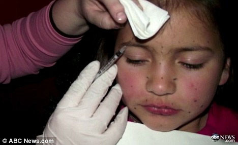  Cứ ba tháng một lần chuyên gia làm đẹp Kerry lại cho con gái Britney lên bàn thẩm mỹ và tiêm botox vào mặt cô bé