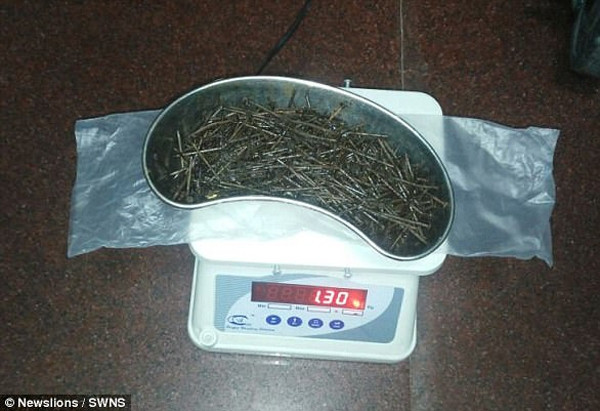 Kỳ lạ người phụ nữ 'sản xuất' cả vốc kim, đinh nhọn trong chân ảnh 5